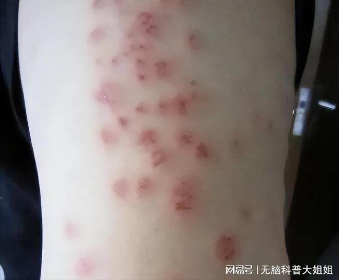 灭臭虫的最好方法_速灭臭虫_灭臭虫药纸哪里可以买到