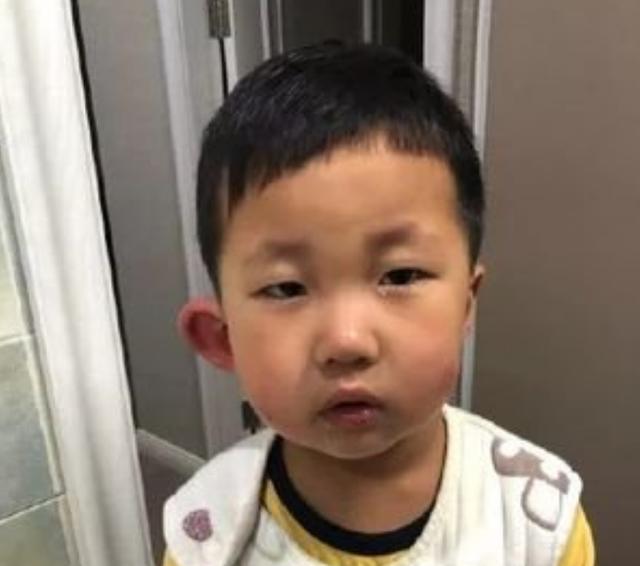 灭跳蚤妙招_灭跳蚤神器_灭跳蚤