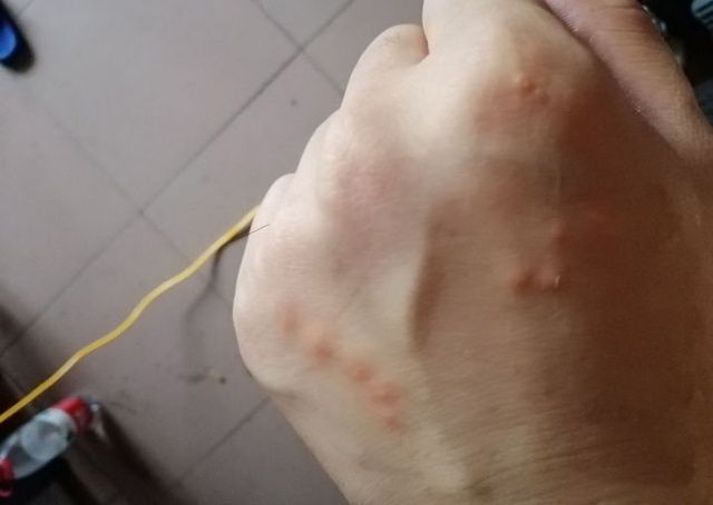 室内臭虫怎么消灭_室内杀臭虫什么药最好_室内灭臭虫