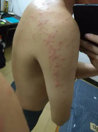灭臭虫的方法_灭臭虫效果最好的药_灭臭虫知识
