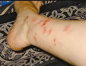 灭臭虫效果最好的药_灭臭虫的方法_灭臭虫知识