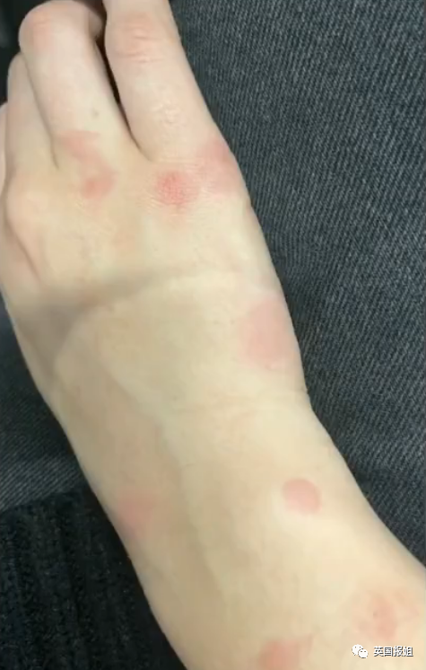 灭杀臭虫用什么药好_灭臭虫杀虫剂_剂灭杀虫臭虫多久见效