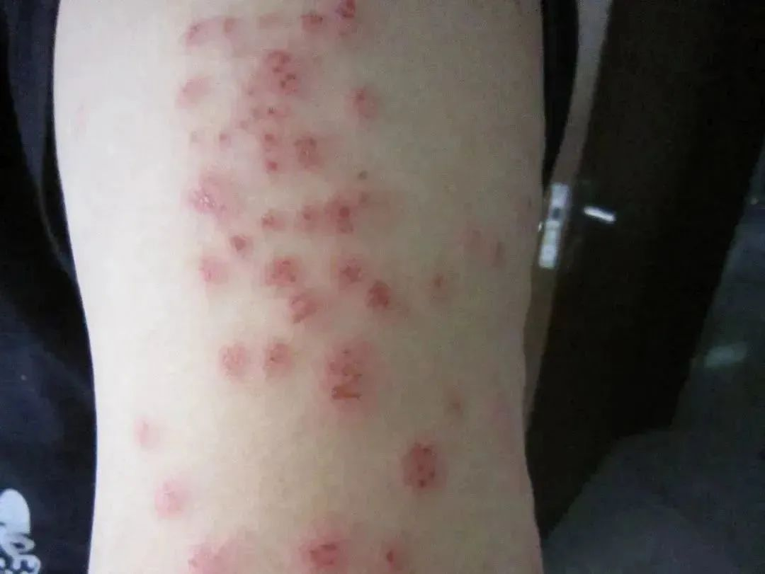 灭臭虫杀虫剂_剂灭杀虫臭虫多久见效_杀臭虫药剂