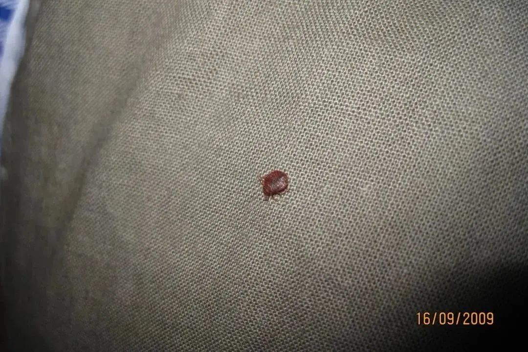 杀臭虫药剂_灭臭虫杀虫剂_剂灭杀虫臭虫多久见效